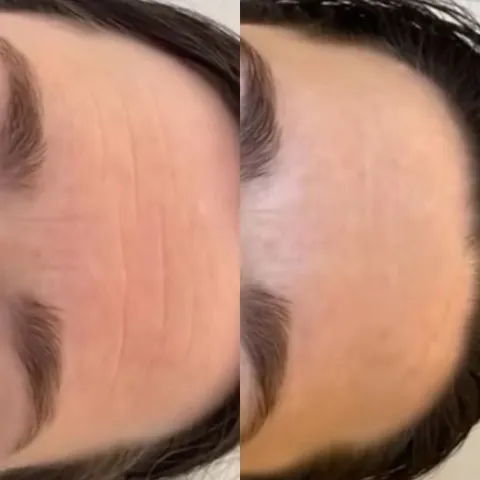 Изображение 2 из 7 в галерее "Skin Integral"