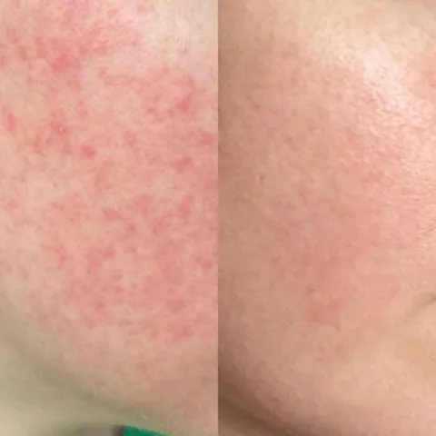 Изображение 4 из 7 в галерее "Skin Integral"