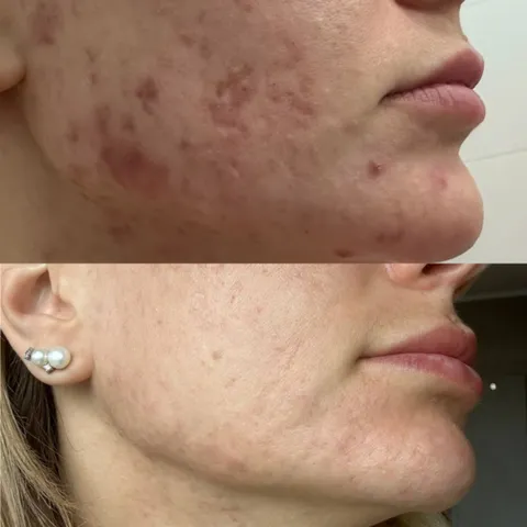 Изображение 5 из 7 в галерее "Skin Integral"