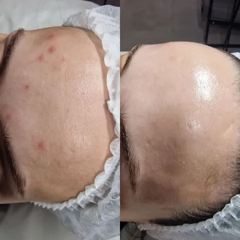 Изображение 6 из 7 в галерее "Skin Integral"
