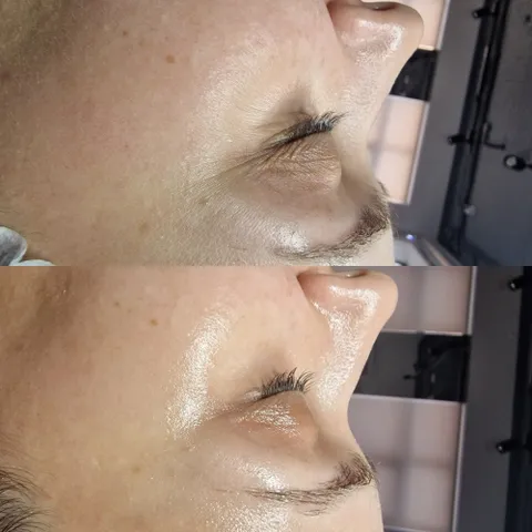 Изображение 7 из 7 в галерее "Skin Integral"