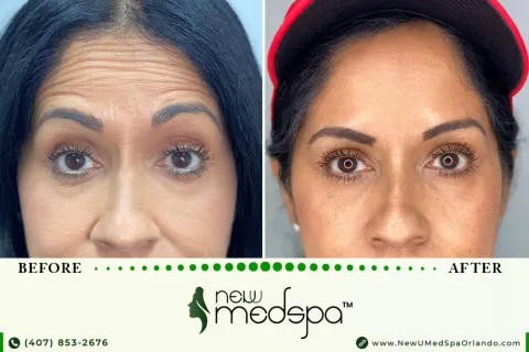 "New U Med Spa Orlando" gallery image 1 of 2
