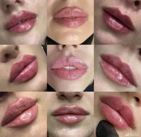 Изображение 5 из 6 в галерее "Cosmed"