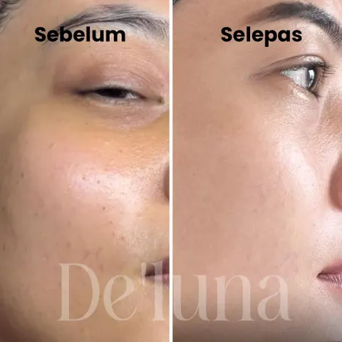 "Deluna Head Spa & Aesthetic" gallery image 2 of 5