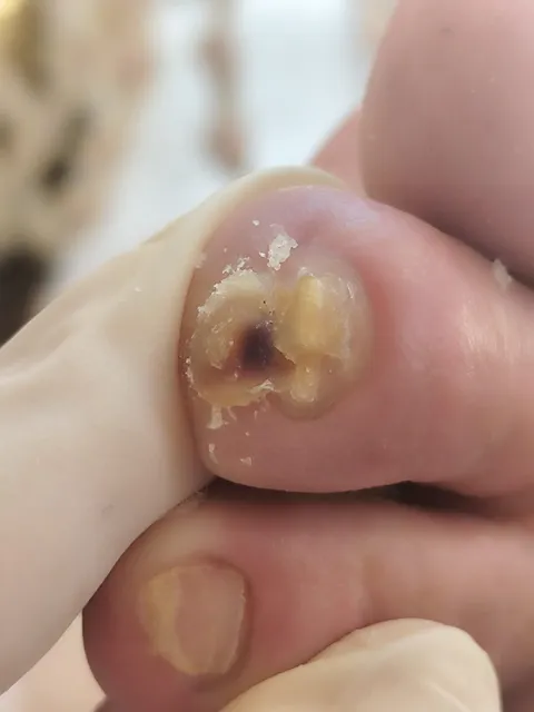 Imagem 6 de 14 na galeria de "Pabreu Pedicure Medical - Podóloga(Brasil)"