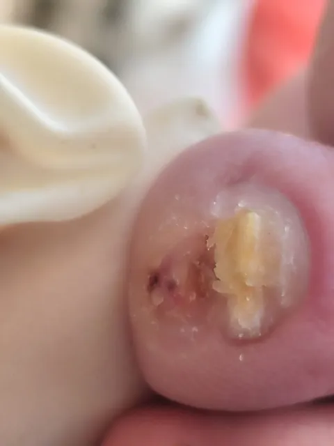 Imagem 5 de 14 na galeria de "Pabreu Pedicure Medical - Podóloga(Brasil)"