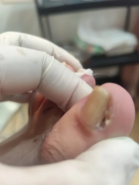 Imagem 8 de 14 na galeria de "Pabreu Pedicure Medical - Podóloga(Brasil)"