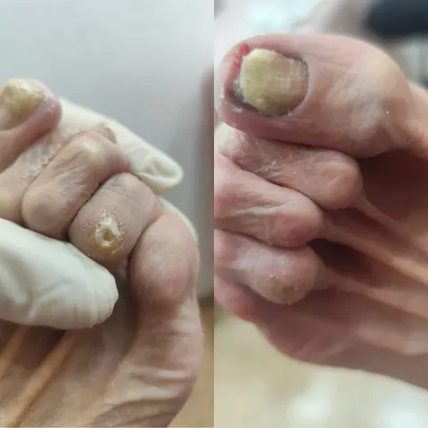 Imagem 2 de 14 na galeria de "Pabreu Pedicure Medical - Podóloga(Brasil)"