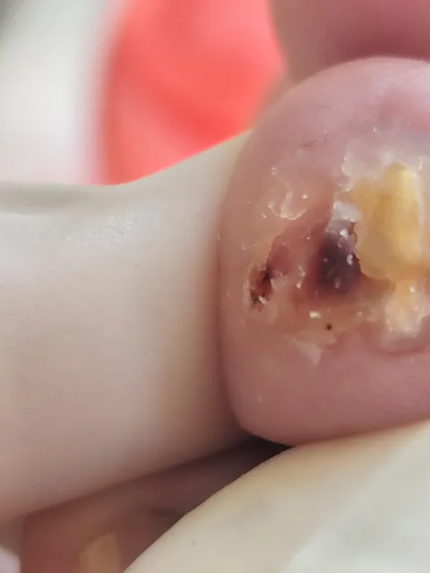 Imagem 4 de 14 na galeria de "Pabreu Pedicure Medical - Podóloga(Brasil)"