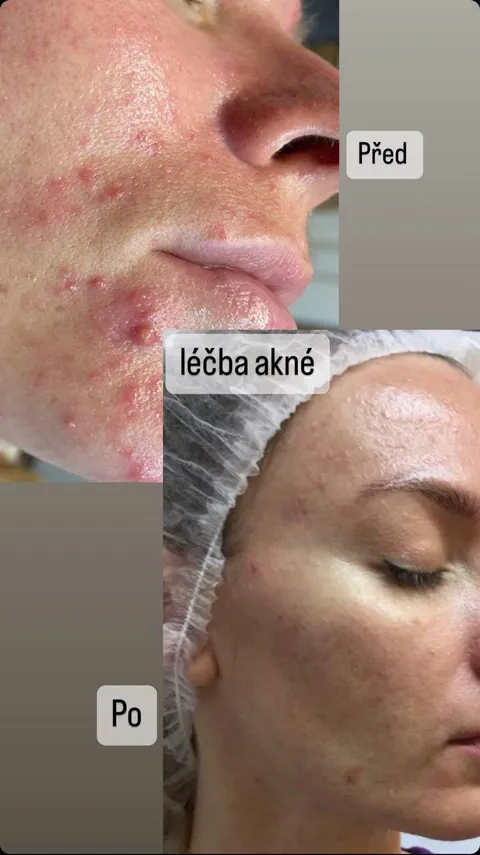 Obrázek 3 z 16 v galerii "Naděžda Abašina"