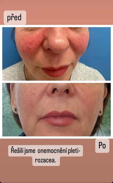 Obrázek 4 z 16 v galerii "Naděžda Abašina"