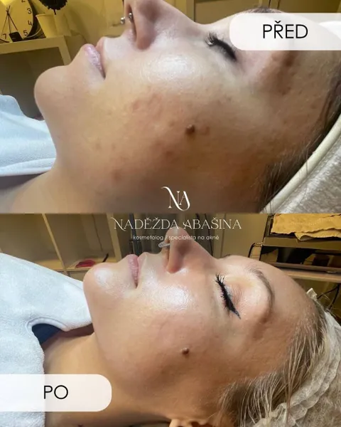 Obrázek 8 z 16 v galerii "Naděžda Abašina"