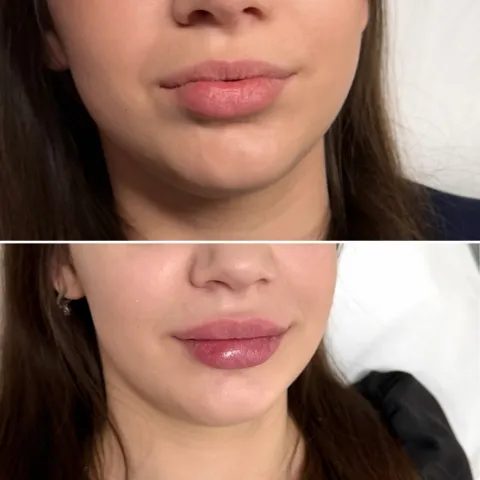 Зображення 1 з 5 у галереї "MK COSMETOLOGY"