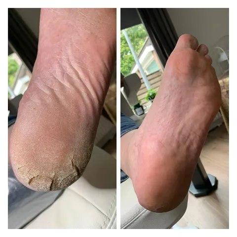 Afbeelding 2 van 6 in de galerij van "Pedicure Treatment & Massage"