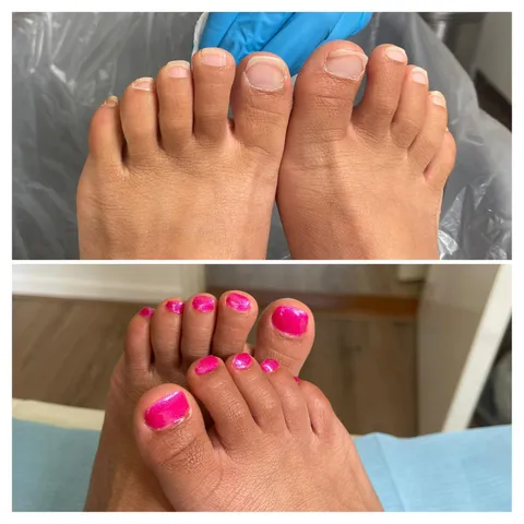 Afbeelding 3 van 6 in de galerij van "Pedicure Treatment & Massage"