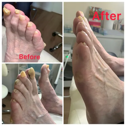 Afbeelding 1 van 6 in de galerij van "Pedicure Treatment & Massage"