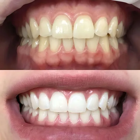 Зображення 1 з 3 у галереї "DentalSvit"
