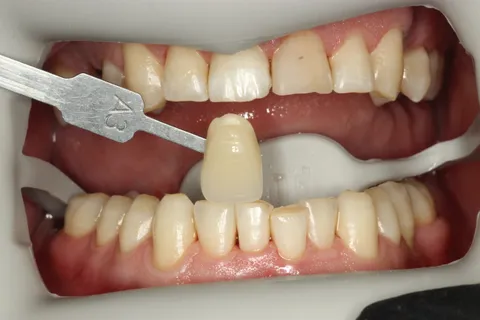 Зображення 2 з 3 у галереї "DentalSvit"