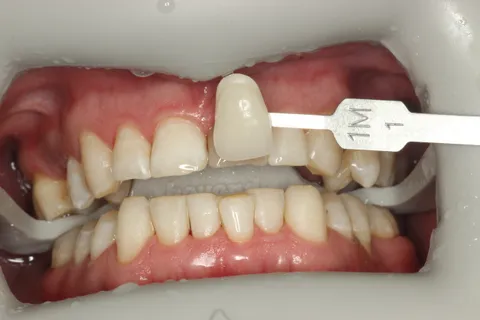 Зображення 3 з 3 у галереї "DentalSvit"
