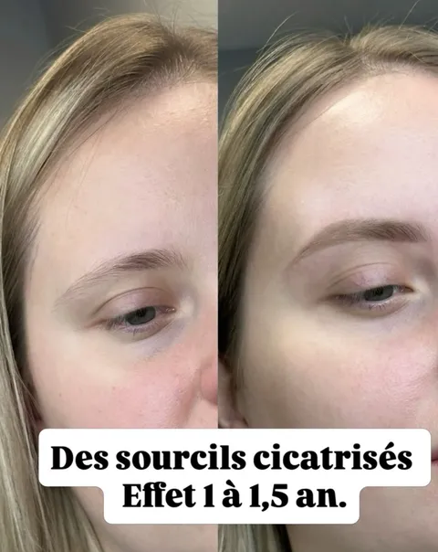 Image 4 sur 9 de la galerie « NOVIKOVA ANNA MAQUILLAGE PERMANENT & DÈTATOUAGE »