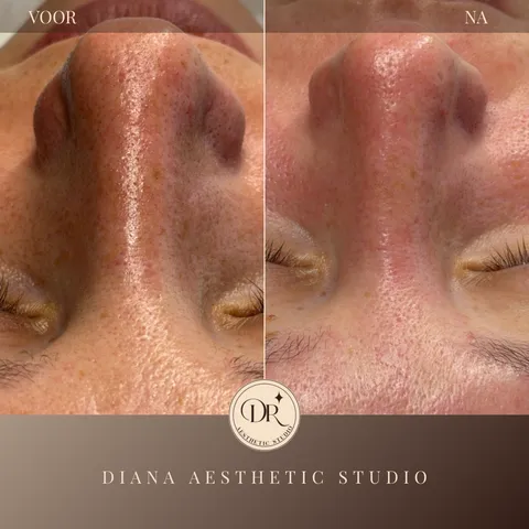 Afbeelding 2 van 17 in de galerij van "Diana Aesthetic Studio"
