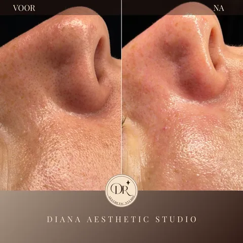 Afbeelding 3 van 17 in de galerij van "Diana Aesthetic Studio"