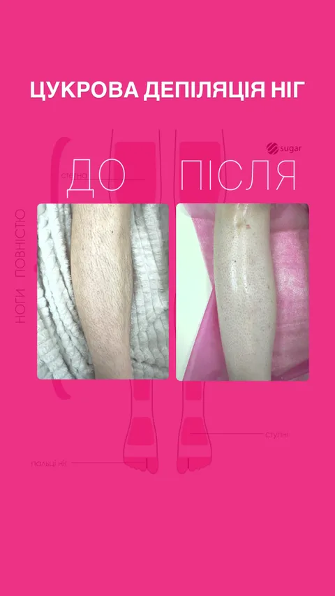 Зображення 9 з 24 у галереї "Go.Sugar🎀"