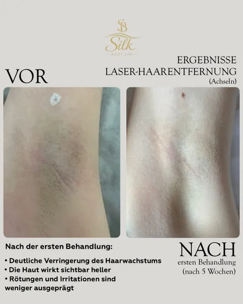 Bild 8 von 14 in der Galerie von "Silk Body Lab"