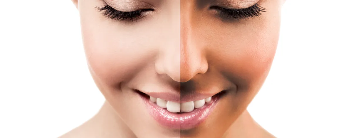 Как выбрать солярий 