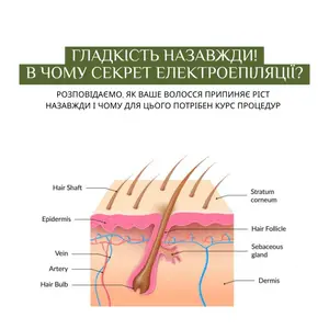 Студія електроепіляції EPIL.KO