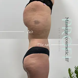 Profi_Massage/cosmetic_IF photo 2