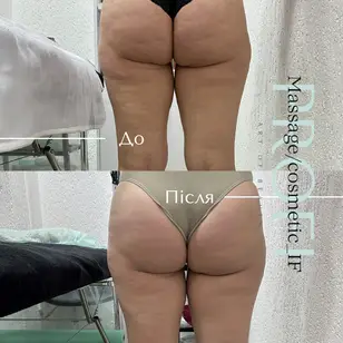 Profi_Massage/cosmetic_IF photo 5