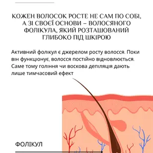 Студія електроепіляції EPIL.KO photo 5