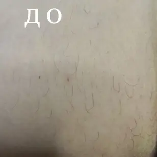 Студія електроепіляції EPIL.KO photo 2