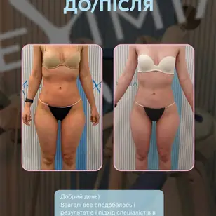 Fit Empire Body Studio | Корекція фігури photo 2