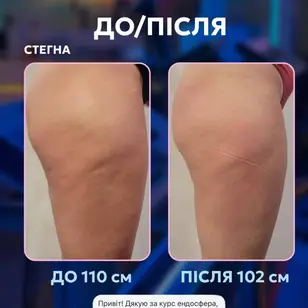 Fit Empire Body Studio | Корекція фігури photo 4