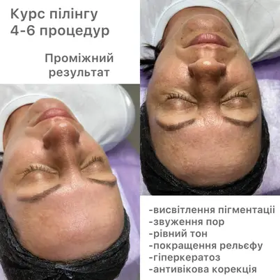 Студія Повітруля & Навчальний центр Регенерація photo 6