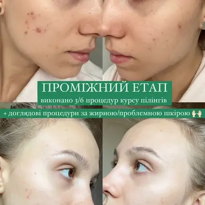 Студія Повітруля & Навчальний центр Регенерація photo 17