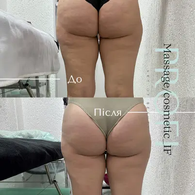 Profi_Massage/cosmetic_IF photo 5