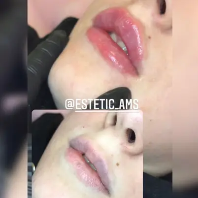 estetic_ams photo 15