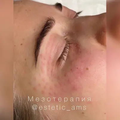 estetic_ams photo 24
