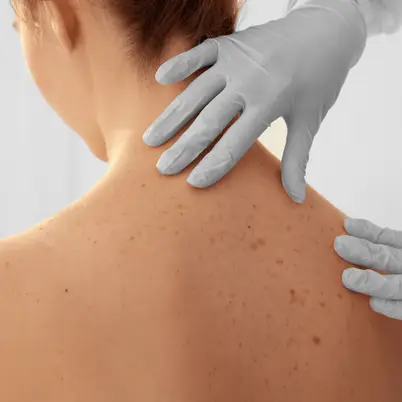 Face Bliss Skin Care photo 5