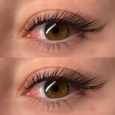 Primrose Esthetic photo 14