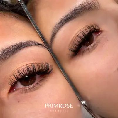 Primrose Esthetic photo 20