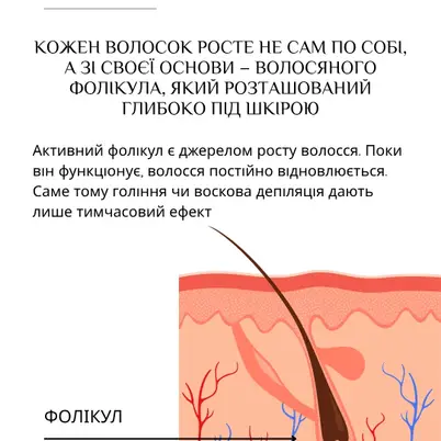 Студія електроепіляції EPIL.KO photo 5