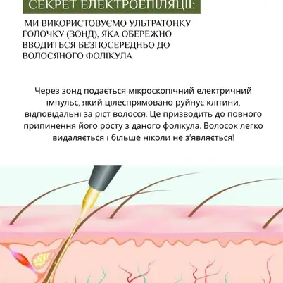 Студія електроепіляції EPIL.KO photo 8