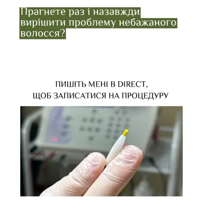 Студія електроепіляції EPIL.KO photo 6