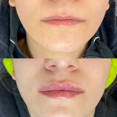 Dr. Anastasiia Matiashok photo 8