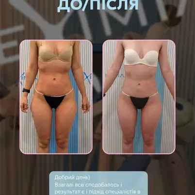 Fit Empire Body Studio | Корекція фігури photo 2