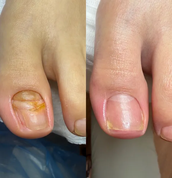 https://storage2.easyweek.io/processed/images/2026-08-23/f13e7b3bcbadb1cff80ccaac4515b406296368a03278df1a84b7edb719bdda7d_1440x1440.jpeg